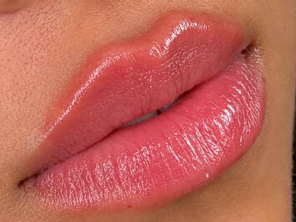 Filler — After