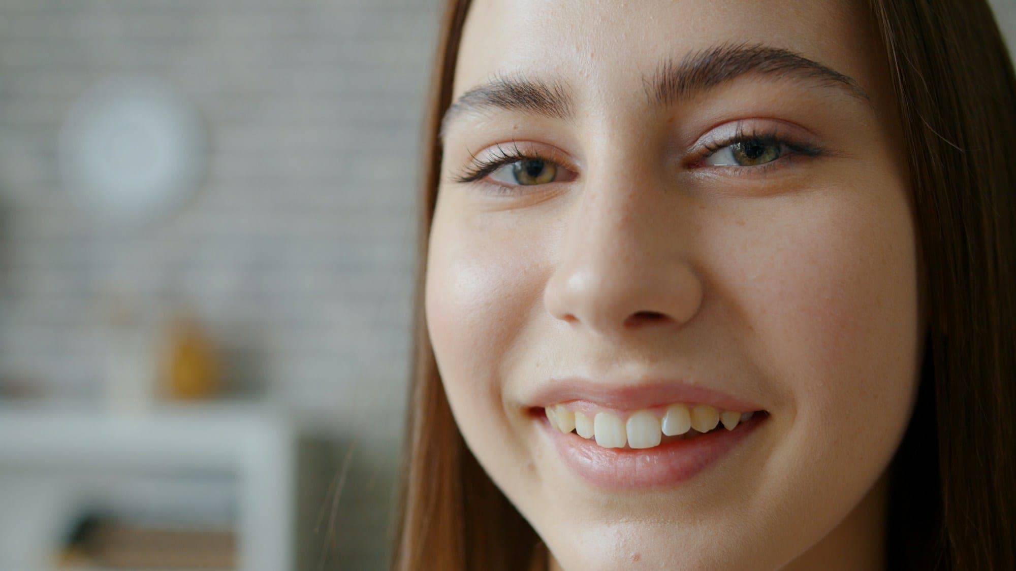 Sample facial comparison image (placeholder) — After